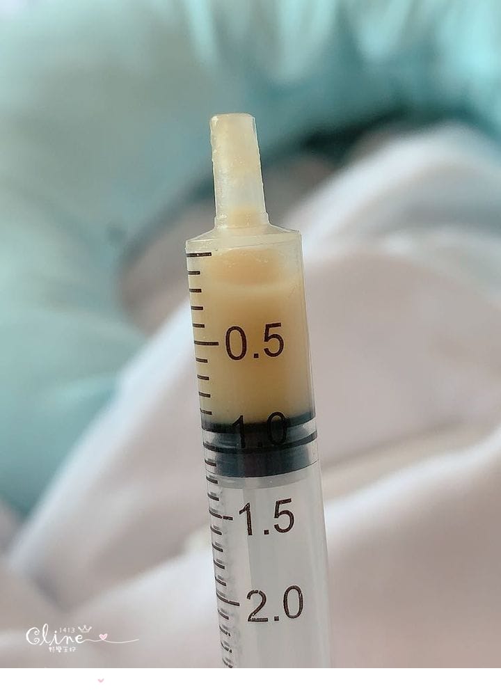 ▎39w1d生產紀錄▎第五胎自然產!禾馨新生婦幼診所x LDR樂得兒病房催生。無痛分娩紀錄