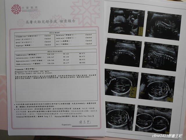 ▌四寶弟孕期紀錄▌孕期紀錄♥22週禾馨高層次超音波、11週非侵入性產前染色體檢測NIPS♥