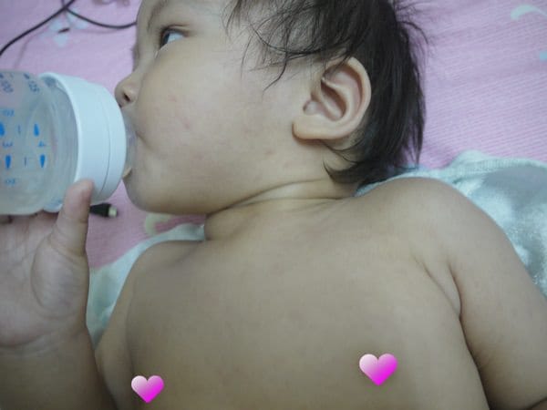 ▌三寶媽碎碎念▌【1Y】傳說中,不到最後不會知道的♥玫瑰疹♥終於來報到了!!!