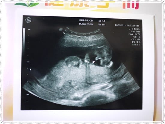 ▌三寶媽碎碎念▌14w~17w ♥ 三寶性別大開獎