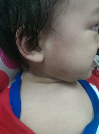 ▌三寶媽碎碎念▌【1Y】傳說中,不到最後不會知道的♥玫瑰疹♥終於來報到了!!!